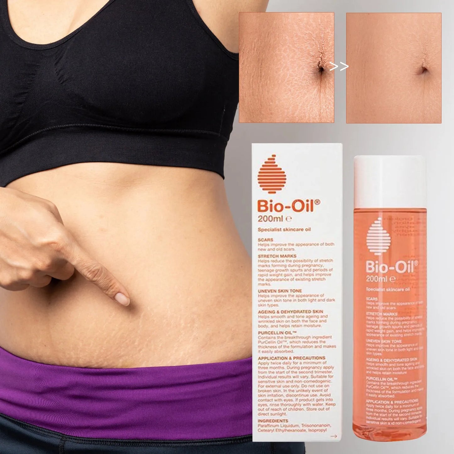 Stretch Mark Oil with Rosehip & Vitamin E