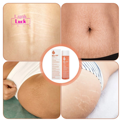 Stretch Mark Oil with Rosehip & Vitamin E