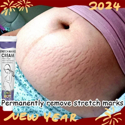 Stretch Mark Treatment/Repair Essential Oil