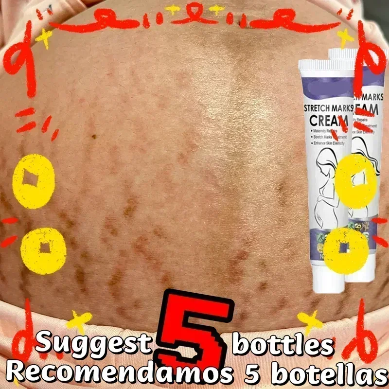 Stretch Mark Treatment/Repair Essential Oil