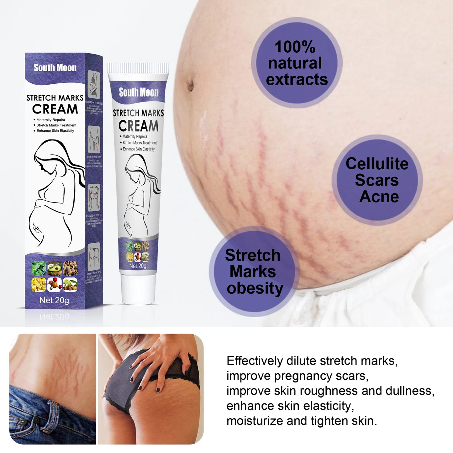 Stretch Marks Cream Smoothing and Nourishing Moisturiser