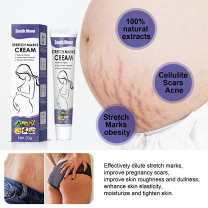 Stretch Marks Cream Smoothing and Nourishing Moisturiser
