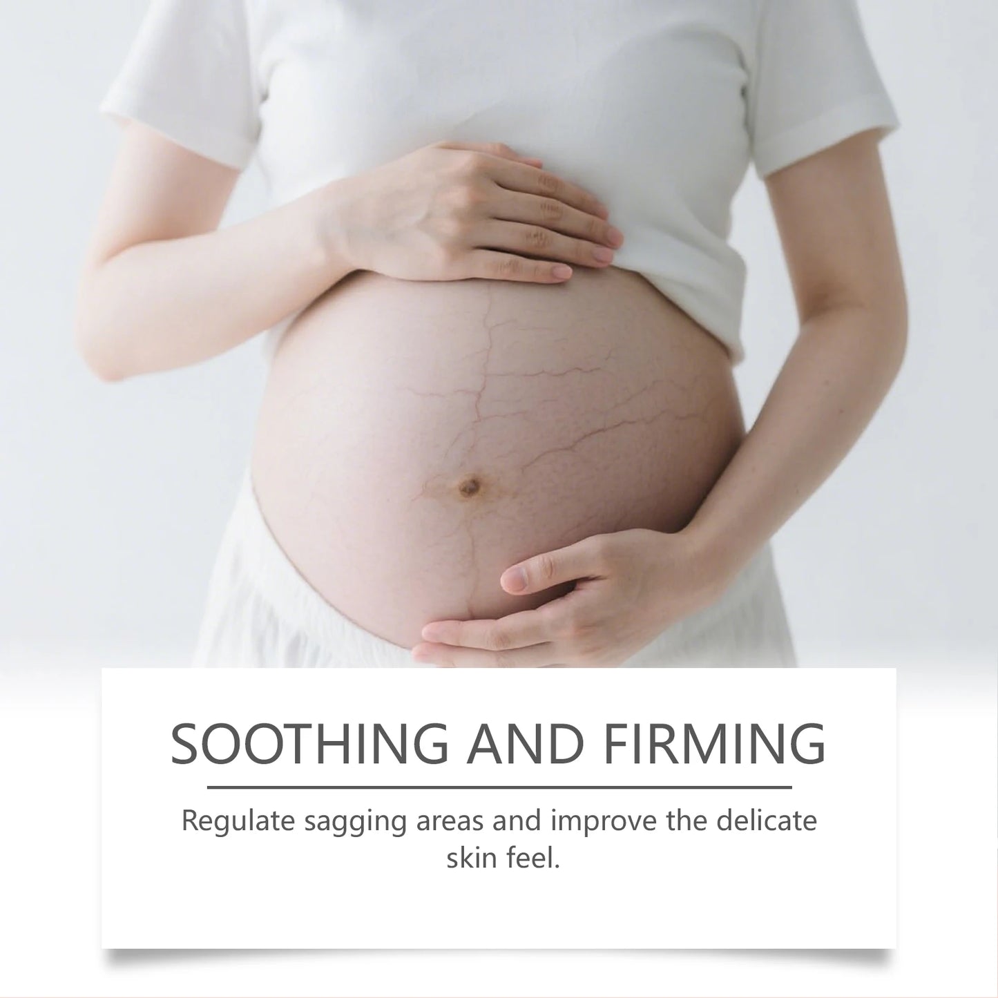 Stretch Mark Repair Cream