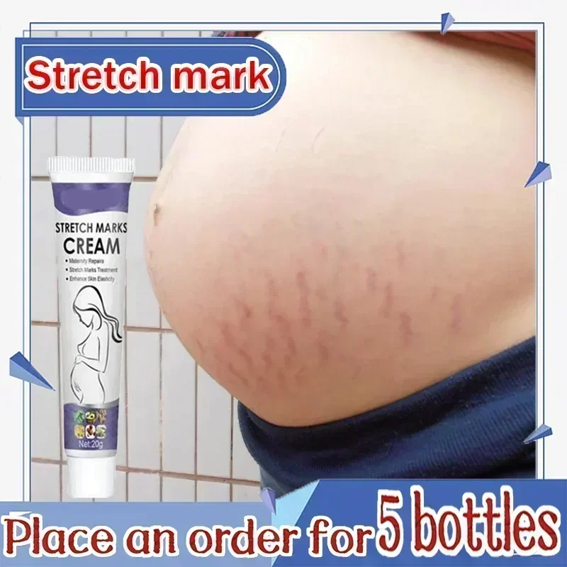 Stretch Mark Treatment/Repair Essential Oil