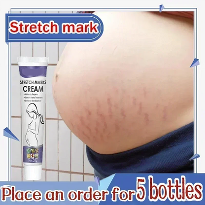 Stretch Mark Treatment/Repair Essential Oil