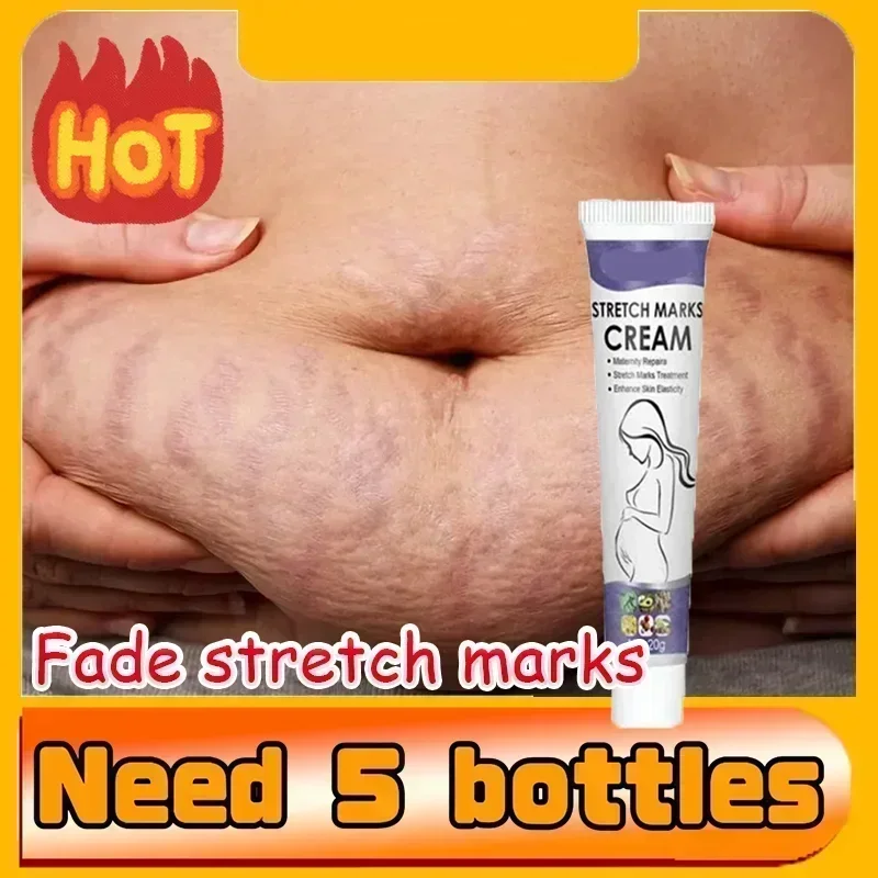 Stretch Mark Treatment/Repair Essential Oil